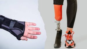 Órtesis y prótesis personalizadas en Almería para mejorar la autonomía y la funcionalidad