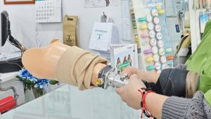 Ajustando la prótesis inferior para el verano